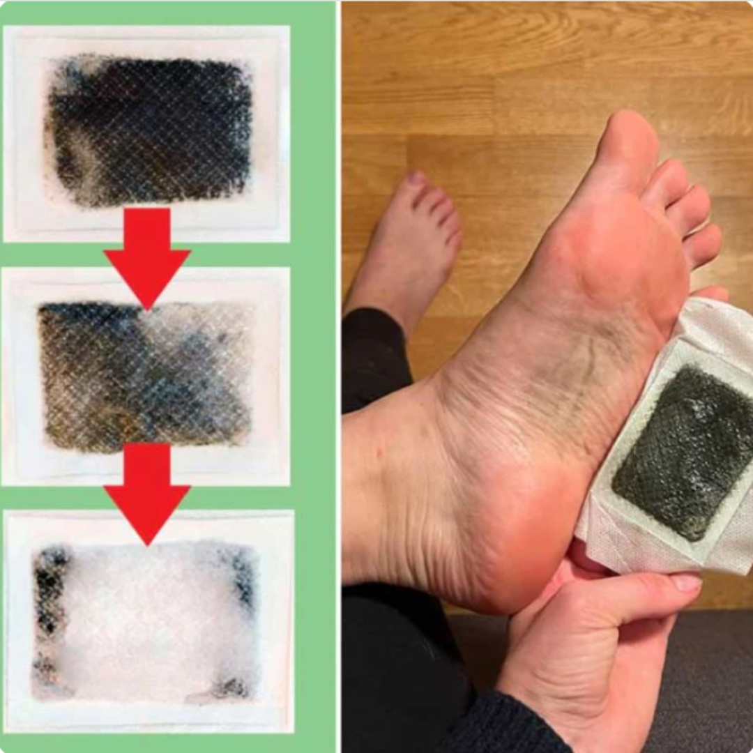 Kinoki Detox Foot Patches | Restore Balance | Helps in Fat Loss